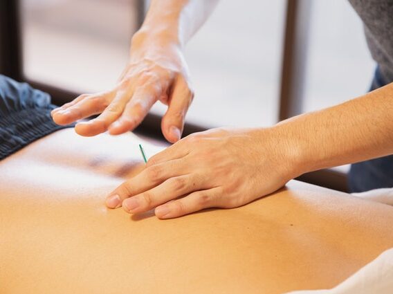 acupuncture-photo-2